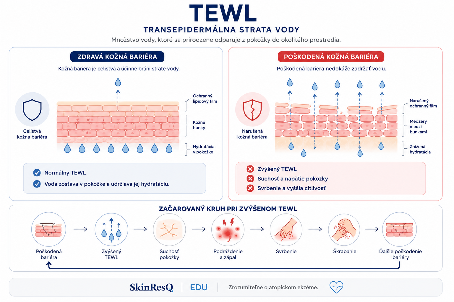 Infografika TEWL